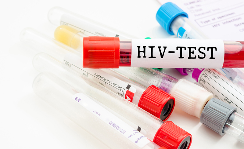 photo-hiv-test